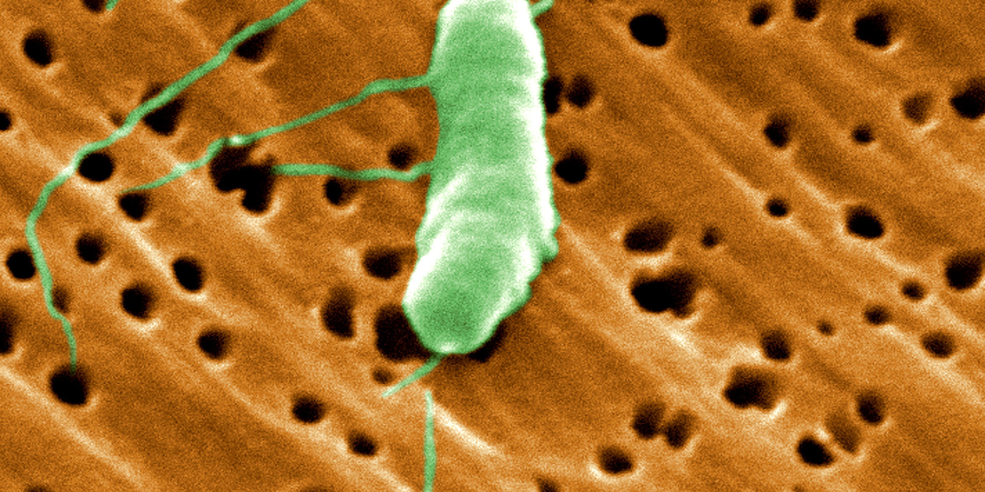 Vibrio vulnificus caracteristicas